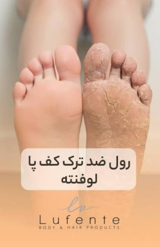 رول مرطوب کننده وآبرسان تخصصی مناسب ترک های کف پا برند لوفنته